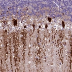 Anti-ARHGEF33 Antibody