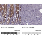 Anti-ACOT11 Antibody