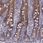 Immunohistochemical staining of human duodenum shows high expression.