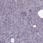 Immunohistochemical staining of human pancreas shows low expression as expected.
