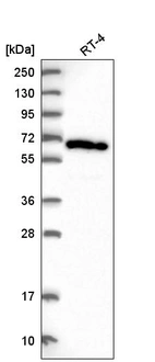 Western blot analysis in human cell line RT-4.