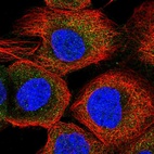 Immunofluorescent staining of human cell line A-431 shows localization to cytosol.
