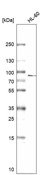 Anti-DDX18 Antibody