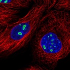 Immunofluorescent staining of human cell line A-431 shows localization to nucleoli.