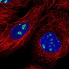 Immunofluorescent staining of human cell line A-431 shows localization to nucleoli.