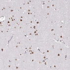 Anti-HNRNPU Antibody