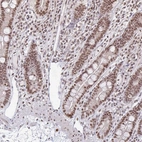 Immunohistochemical staining of human small intestine shows strong nuclear positivity in glandular cells.