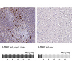 Anti-IL18BP Antibody