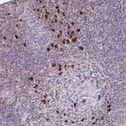 Immunohistochemical staining of human lymph node shows strong cytoplasmic positivity in non-germinal center cells.