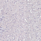 Immunohistochemical staining of human liver shows no cytoplasmic positivity in hepatocytes.
