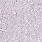 Immunohistochemical staining of human liver shows no cytoplasmic positivity in hepatocytes.