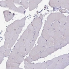 Immunohistochemical staining of human skeletal muscle shows no positivity in myocytes.