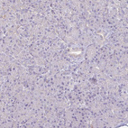 Immunohistochemical staining of human pancreas shows no cytoplasmic positivity in exocrine glandular cells as expected.
