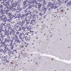 Anti-HECTD4 Antibody