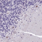 Anti-HECTD4 Antibody