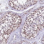 Immunohistochemical staining of human testis shows moderate nuclear positivity in cells in seminiferous ducts.