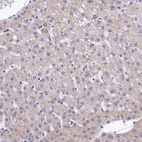 Immunohistochemical staining of human liver shows no nuclear positivity in hepatocytes as expected.