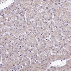 Immunohistochemical staining of human liver shows no nuclear positivity in hepatocytes as expected.