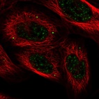 Immunofluorescent staining of human cell line U-2 OS shows localization to nuclear speckles & vesicles.