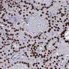 Immunohistochemical staining of human parathyroid gland shows strong nuclear positivity in glandular cells.
