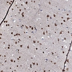 Immunohistochemical staining of human cerebral cortex shows strong nuclear and cytoplasmic positivity in neurons.