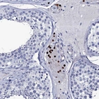 Immunohistochemical staining of human testis shows strong nuclear positivity in Leydig cells.