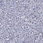Immunohistochemical staining of human liver shows no positivity in hepatocytes as expected.