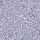 Anti-NPM2 Antibody