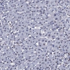 Immunohistochemical staining of human liver shows no positivity in hepatocytes as expected.