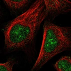 Immunofluorescent staining of human cell line U-2 OS shows localization to nucleus & nucleoli.