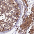 Immunohistochemical staining of human testis using Anti-MKKS antibody HPA041071.