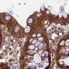 Immunohistochemical staining of human colon using Anti-MKKS antibody HPA041071.