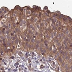 Immunohistochemical staining of human urinary bladder using Anti-MKKS antibody HPA041071.
