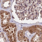 Immunohistochemical staining of human kidney using Anti-MKKS antibody HPA041071.