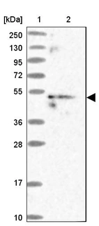 Lane 1: Marker [kDa] 250, 130, 95, 72, 55, 36, 28, 17, 10_br/_Lane 2: Human cell line RT-4