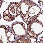 Anti-N4BP1 Antibody