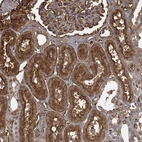 Anti-KIF22 Antibody