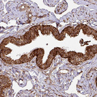 Immunohistochemical staining of human fallopian tube shows strong to very strong granular cytoplasmic positivity in glandular cells.