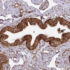 Immunohistochemical staining of human fallopian tube shows strong to very strong granular cytoplasmic positivity in glandular cells.