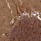 Immunohistochemical staining of human cerebellum shows moderate to strong granular cytoplasmic positivity in Purkinje cells.
