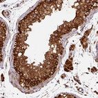 Immunohistochemical staining of human testis shows moderate to strong granular cytoplasmic positivity in seminiferous ducts.
