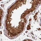 Immunohistochemical staining of human testis shows moderate to strong granular cytoplasmic positivity in seminiferous ducts.
