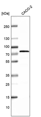 Western blot analysis in human cell line CACO-2.