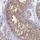 Anti-WDR59 Antibody