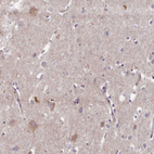 Immunohistochemical staining of human cerebral cortex shows weak granular cytoplasmic positivity in neurons.