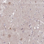 Immunohistochemical staining of human cerebral cortex shows weak granular cytoplasmic positivity in neurons.