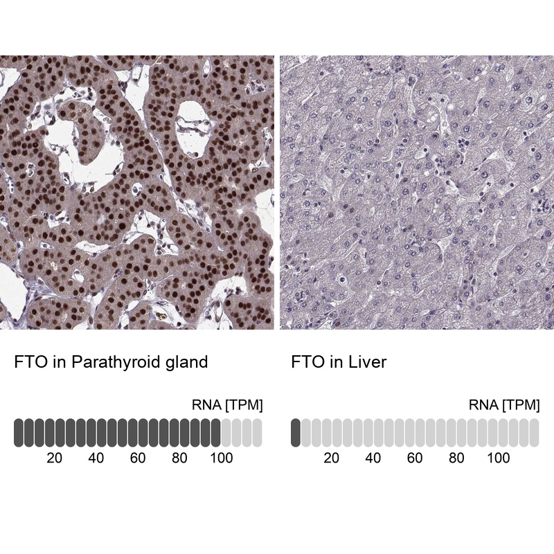 Anti-FTO Antibody