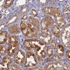 Immunohistochemical staining of human kidney shows moderate granular cytoplasmic positivity in cells in tubules.