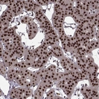 Immunohistochemical staining of human parathyroid gland shows strong nuclear positivity in glandular cells.