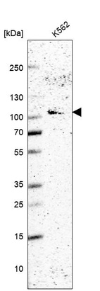 Western blot analysis in human cell line K562.